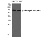 Western Blot - Anti-SF1 (phospho Ser82) Antibody (A0572) - Antibodies.com