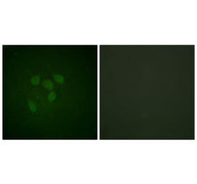 Immunofluorescence - Anti-p53 (acetyl Lys317) Antibody (D0015) - Antibodies.com