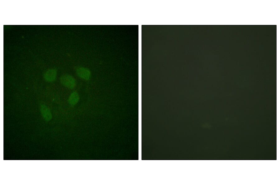 Immunofluorescence - Anti-p53 (acetyl Lys317) Antibody (D0015) - Antibodies.com