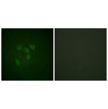 Immunofluorescence - Anti-p53 (acetyl Lys317) Antibody (D0015) - Antibodies.com