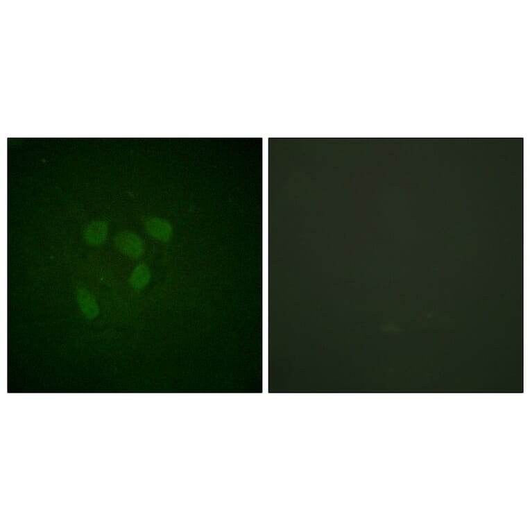 Immunofluorescence - Anti-p53 (acetyl Lys317) Antibody (D0015) - Antibodies.com
