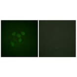 Immunofluorescence - Anti-p53 (acetyl Lys317) Antibody (D0015) - Antibodies.com