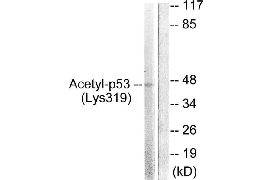 Western Blot - Anti-p53 (acetyl Lys317) Antibody (D0015) - Antibodies.com