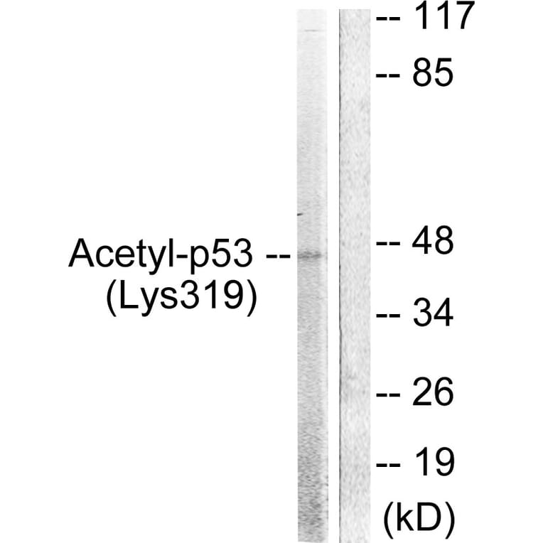 Western Blot - Anti-p53 (acetyl Lys317) Antibody (D0015) - Antibodies.com