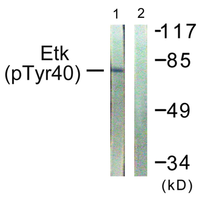 Western Blot - Anti-ETK (phospho Tyr40) Antibody (A0645) - Antibodies.com