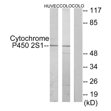 Western Blot - Anti-Cytochrome P450 2S1 Antibody (C12271) - Antibodies.com