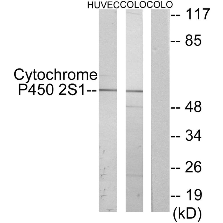 Western Blot - Anti-Cytochrome P450 2S1 Antibody (C12271) - Antibodies.com