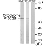 Western Blot - Anti-Cytochrome P450 2S1 Antibody (C12271) - Antibodies.com