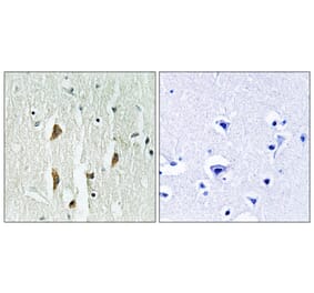 Immunohistochemistry - Anti-PAK1 + PAK2 + PAK3 Antibody (B0540) - Antibodies.com