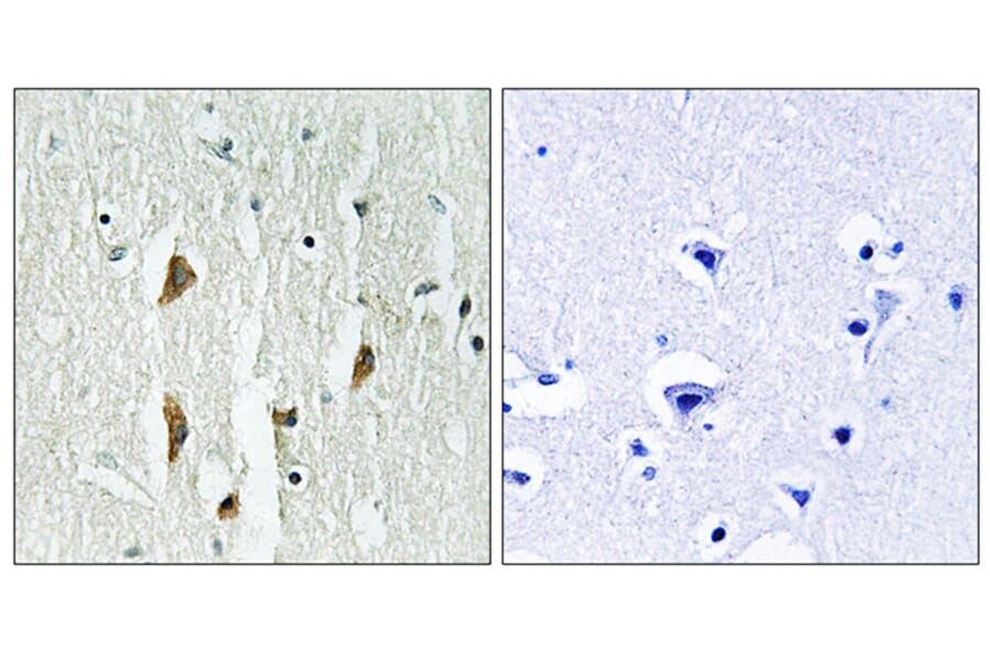 Immunohistochemistry - Anti-PAK1 + PAK2 + PAK3 Antibody (B0540) - Antibodies.com