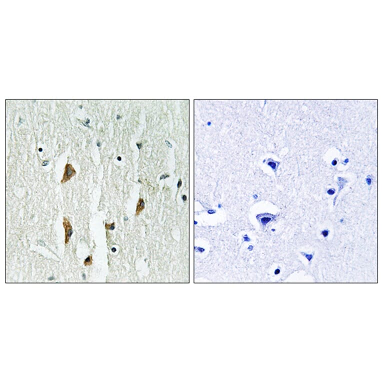 Immunohistochemistry - Anti-PAK1 + PAK2 + PAK3 Antibody (B0540) - Antibodies.com