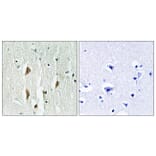 Immunohistochemistry - Anti-PAK1 + PAK2 + PAK3 Antibody (B0540) - Antibodies.com