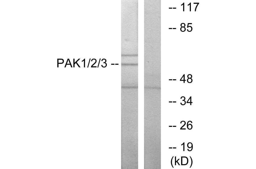 Western Blot - Anti-PAK1 + PAK2 + PAK3 Antibody (B0540) - Antibodies.com