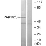 Western Blot - Anti-PAK1 + PAK2 + PAK3 Antibody (B0540) - Antibodies.com