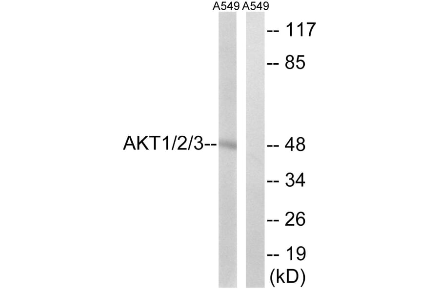 Western Blot - Anti-AKT1 + AKT2 + AKT3 Antibody (B8075) - Antibodies.com