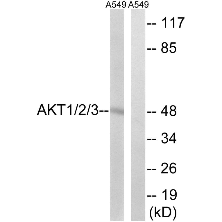 Western Blot - Anti-AKT1 + AKT2 + AKT3 Antibody (B8075) - Antibodies.com