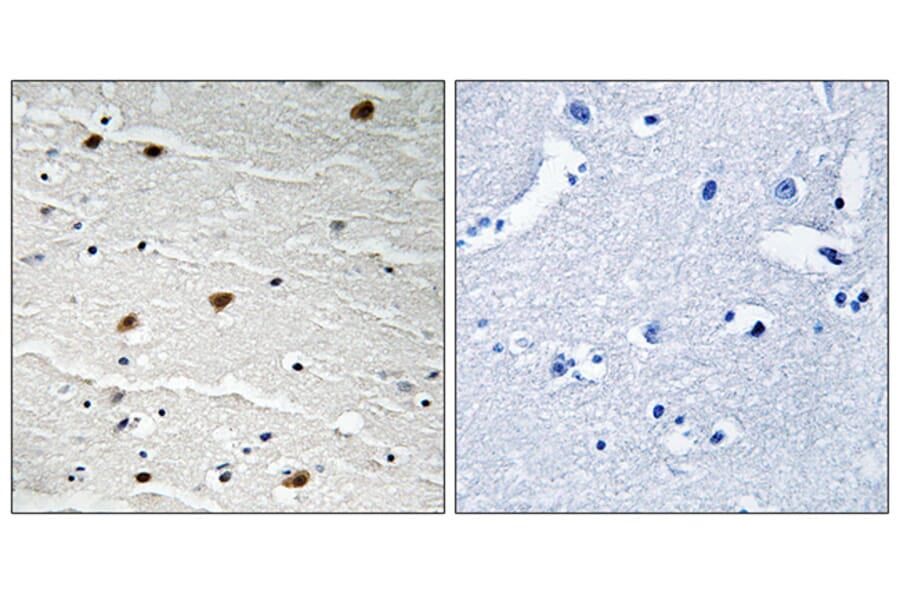 Immunohistochemistry - Anti-AKT1 + AKT2 + AKT3 Antibody (B8075) - Antibodies.com