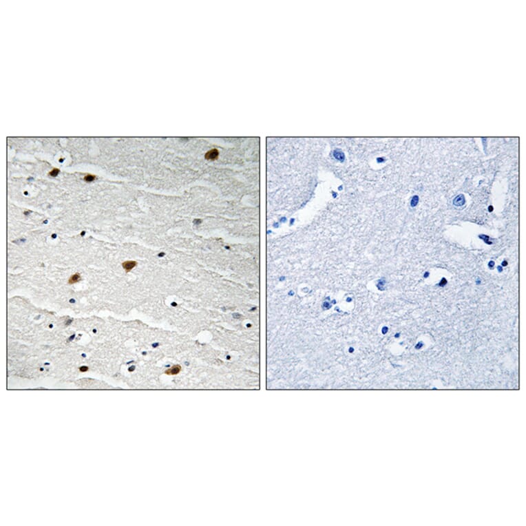 Immunohistochemistry - Anti-AKT1 + AKT2 + AKT3 Antibody (B8075) - Antibodies.com