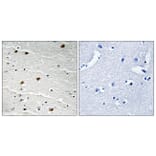Immunohistochemistry - Anti-AKT1 + AKT2 + AKT3 Antibody (B8075) - Antibodies.com