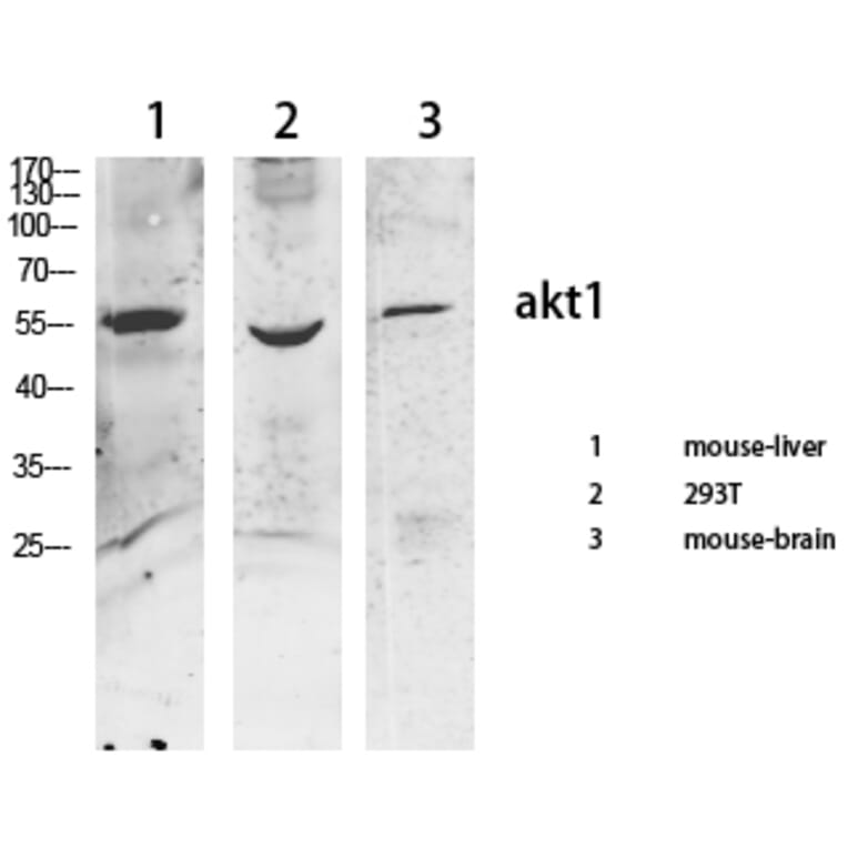 Western Blot - Anti-AKT1 + AKT2 + AKT3 Antibody (B8075) - Antibodies.com