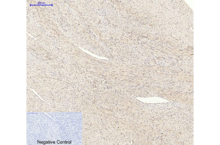 Immunohistochemistry - Anti-AKT1 + AKT2 + AKT3 Antibody (B8075) - Antibodies.com