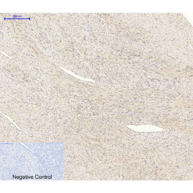 Immunohistochemistry - Anti-AKT1 + AKT2 + AKT3 Antibody (B8075) - Antibodies.com