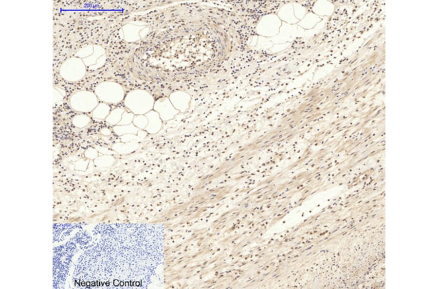 Immunohistochemistry - Anti-AKT1 + AKT2 + AKT3 Antibody (B8075) - Antibodies.com