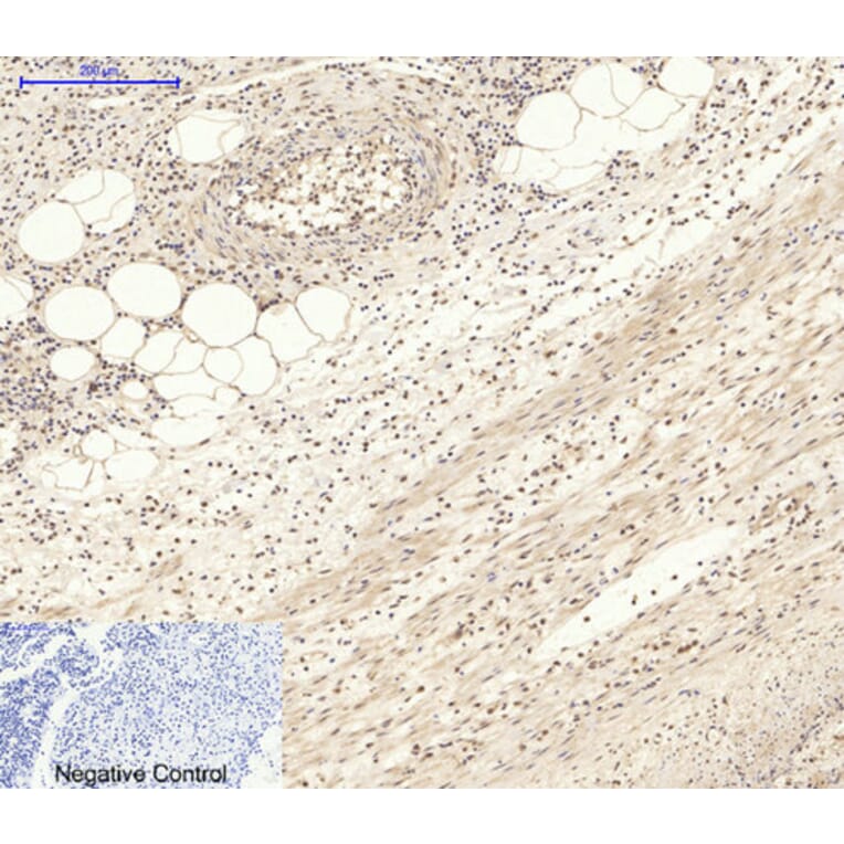 Immunohistochemistry - Anti-AKT1 + AKT2 + AKT3 Antibody (B8075) - Antibodies.com