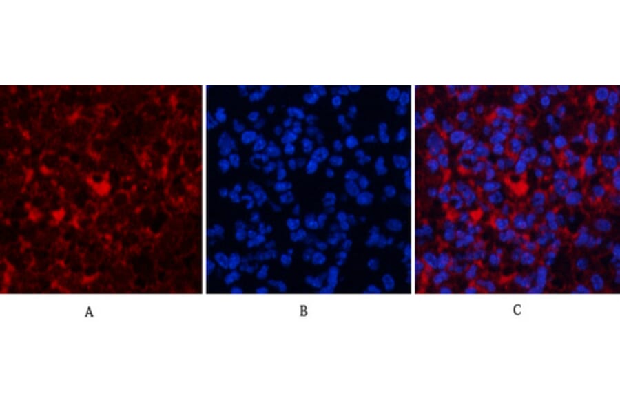 Immunofluorescence - Anti-AKT1 + AKT2 + AKT3 Antibody (B8075) - Antibodies.com