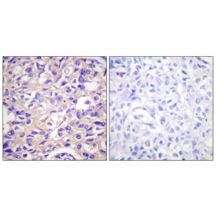 Immunohistochemistry - Anti-TK (phospho Ser13) Antibody (A0586) - Antibodies.com