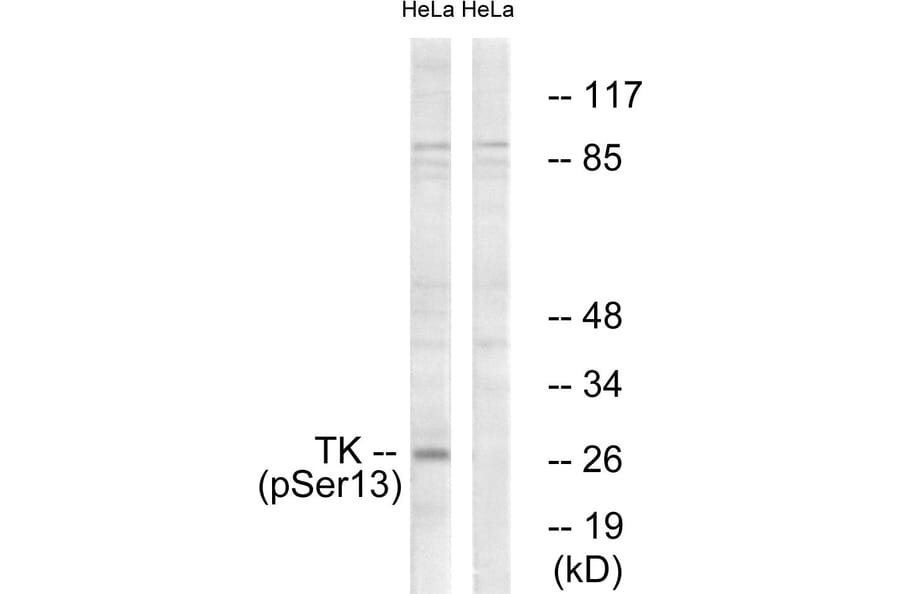 Western Blot - Anti-TK (phospho Ser13) Antibody (A0586) - Antibodies.com
