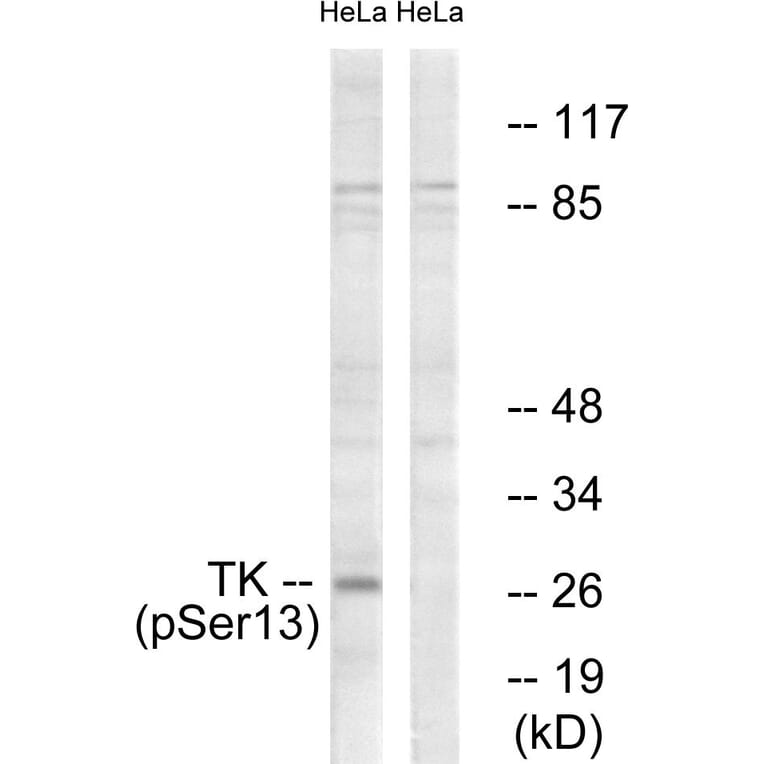 Western Blot - Anti-TK (phospho Ser13) Antibody (A0586) - Antibodies.com