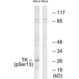 Western Blot - Anti-TK (phospho Ser13) Antibody (A0586) - Antibodies.com