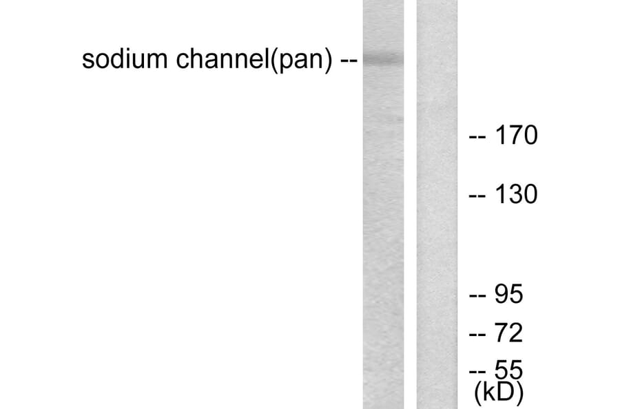 Western Blot - Anti-Sodium Channel-pan Antibody (C0327) - Antibodies.com