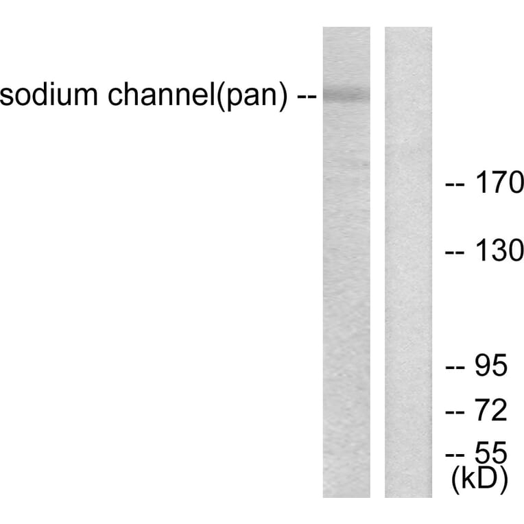 Western Blot - Anti-Sodium Channel-pan Antibody (C0327) - Antibodies.com