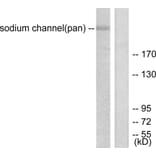 Western Blot - Anti-Sodium Channel-pan Antibody (C0327) - Antibodies.com