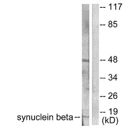 Western Blot - Anti-Synuclein beta Antibody (C0335) - Antibodies.com