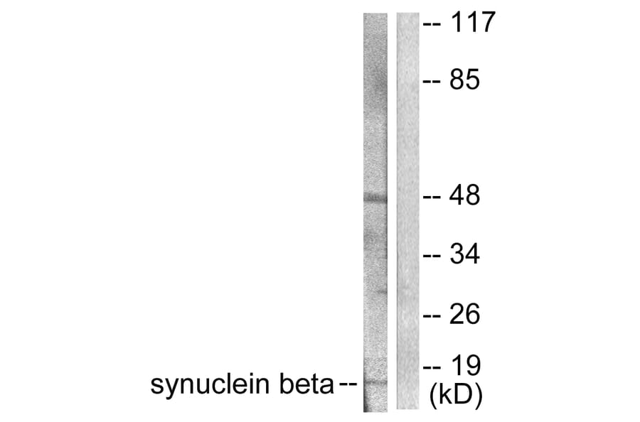 Western Blot - Anti-Synuclein beta Antibody (C0335) - Antibodies.com