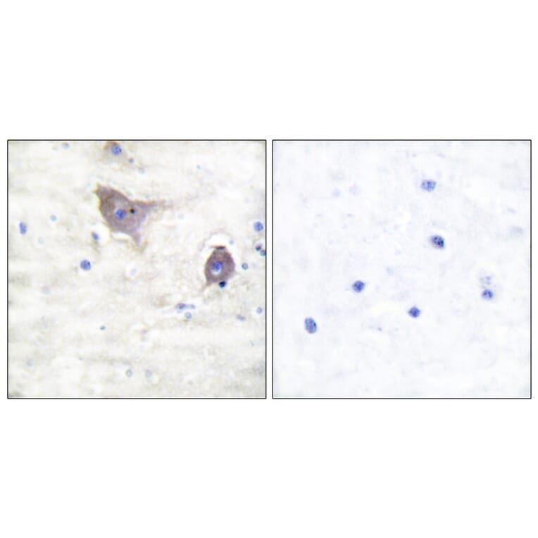 Immunohistochemistry - Anti-Synuclein beta Antibody (C0335) - Antibodies.com