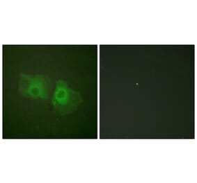 Immunofluorescence - Anti-Keratin 18 Antibody (B0016) - Antibodies.com
