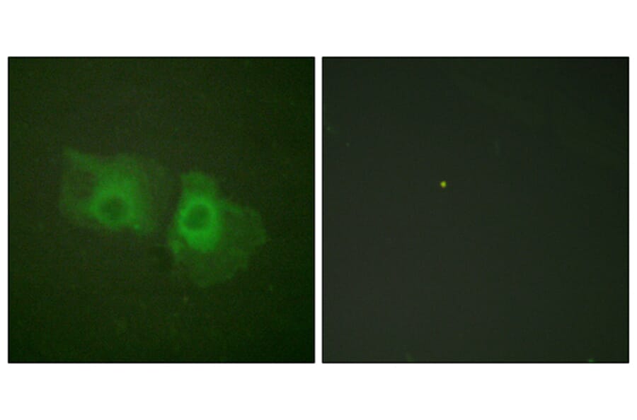Immunofluorescence - Anti-Keratin 18 Antibody (B0016) - Antibodies.com