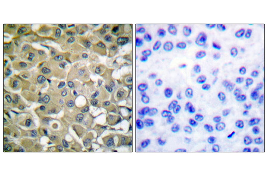 Immunohistochemistry - Anti-Keratin 18 Antibody (B0016) - Antibodies.com