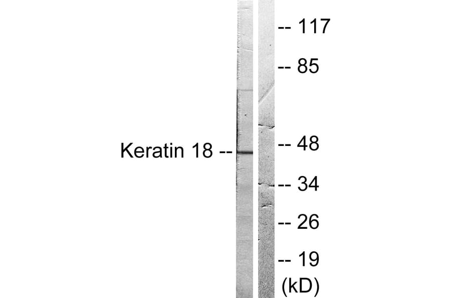 Western Blot - Anti-Keratin 18 Antibody (B0016) - Antibodies.com