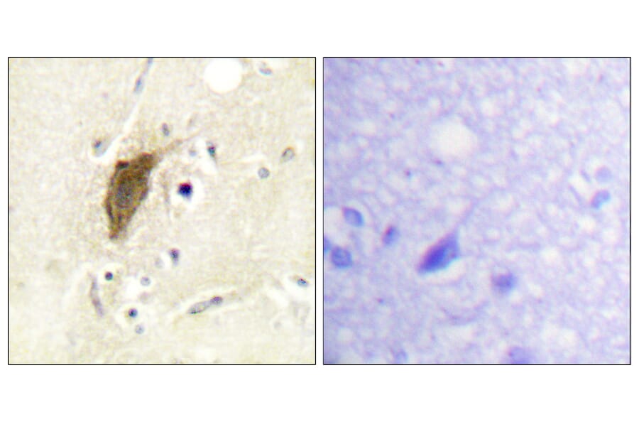 Immunohistochemistry - Anti-Myosin regulatory light chain 2 (phospho Ser18) Antibody (A0690) - Antibodies.com