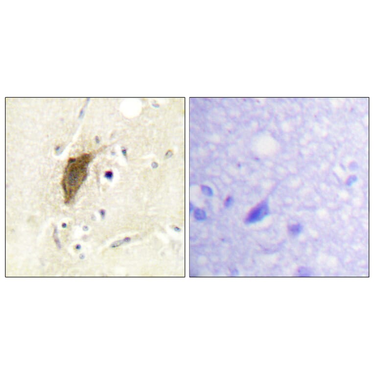 Immunohistochemistry - Anti-Myosin regulatory light chain 2 (phospho Ser18) Antibody (A0690) - Antibodies.com