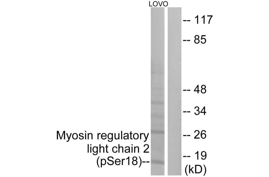 Western Blot - Anti-Myosin regulatory light chain 2 (phospho Ser18) Antibody (A0690) - Antibodies.com