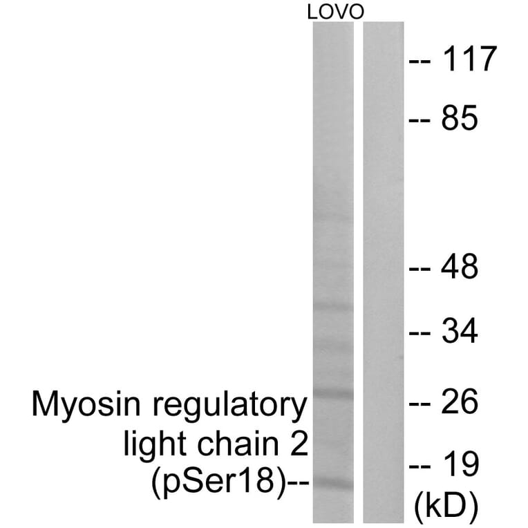 Western Blot - Anti-Myosin regulatory light chain 2 (phospho Ser18) Antibody (A0690) - Antibodies.com