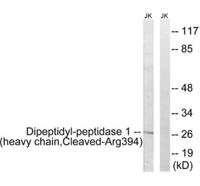Western Blot - Anti-Dipeptidyl-peptidase 1 (heavy chain,cleaved Arg394) Antibody (L0243) - Antibodies.com