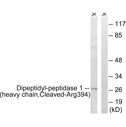 Western Blot - Anti-Dipeptidyl-peptidase 1 (heavy chain,cleaved Arg394) Antibody (L0243) - Antibodies.com