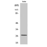 Western Blot - Anti-Dipeptidyl-peptidase 1 (heavy chain,cleaved Arg394) Antibody (L0243) - Antibodies.com